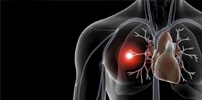 Научная работа - Тромбоэмболия лёгочной артерии: диагностика и лечение